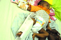 Bayi Lamentiana Daho yang mengalami patah kaki masih mendapat perawatan intensif di RSUD AM Parikesit, Tenggarong